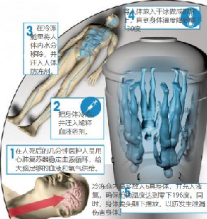 有钱贪生：富豪们都想活到100岁